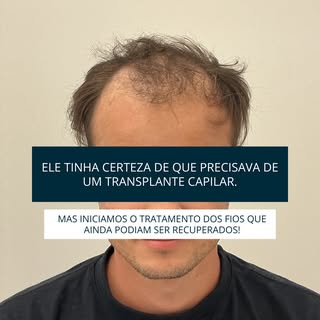 “Eu achei que só transplante resolveria.”

Foi assim que esse paciente chegou ao consultório.
Na ava