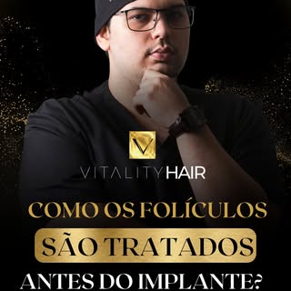 Você tem dúvidas sobre como os fios retirados são tratados antes de serem implantados novamente? Ent