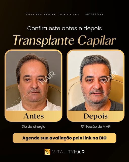 🚨 O resultado começa muito antes do crescimento completo. Começa com a decisão de mudar.

Do dia da