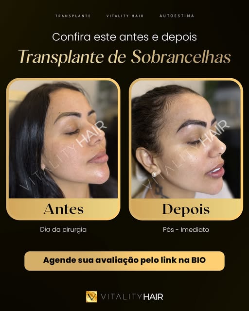 Últimas vagas do mês para quem quer parar de depender da maquiagem para ter as sobrancelhas do jeito
