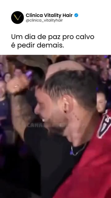 Se a calvície já está te incomodando de verdade, vale entender quais possibilidades existem para o s