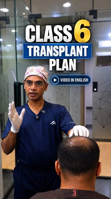 Regain Your Confidence with the Expertise of Dr. Sreedhar Reddy Pothula India’s Leading Hair Transpl