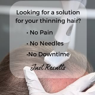 If you have been battling hair loss, it’s time you knew your hair restoration options.

As your loca