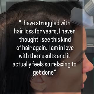 “I have struggled with hair loss for years, I never thought I see this kind of hair again. I am in l