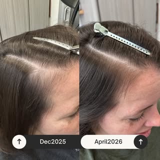 Hair growth is like compounding interest.

At first, it feels slow. Almost like nothing is happening
