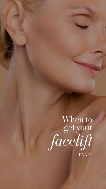 Facelift timing is more than skin deep. There are layers to the decision, and Dr. A takes the time t