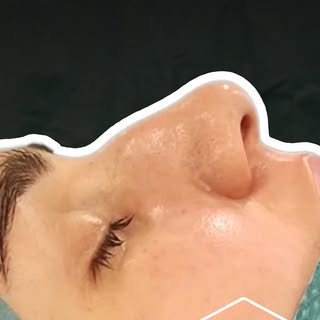 [🇬🇧 in the comment section]

Jedna z częstszych obaw, którą słyszę w gabinecie?
„Panie Doktorze, n