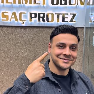 Detay fark yaratır.

Protez saç uygulamamızda ön saç çizgisi,
doğallığın en kritik noktasıdır.

Yakı