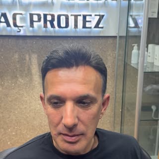 Kimse bunun protez saç olduğuna inanmıyor… 😳

Çünkü çoğu kişinin aklındaki eski sistemleri unut.
Bu