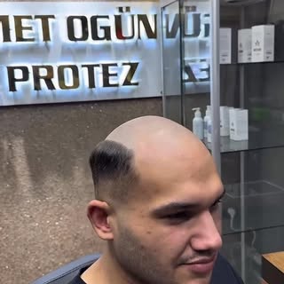 Bu videoda gördüğünüz şey bir saç uygulaması değil.

Bu, yıllardır şapka takan birinin yeniden özgür