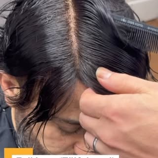 Full Lace (Tül & Dantel) protez saç, saçın doğal görünümünü ön planda tutan özel bir protez türüdür.