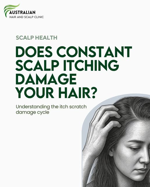 That constant itch on your scalp is not something to keep ignoring.

The more you scratch, the more 