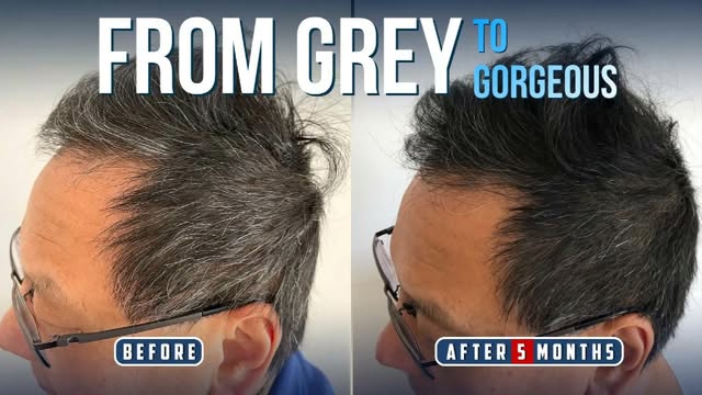 Grey hair can be one of those changes you notice more and more over time.

Here’s a look at his hair