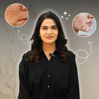 Acne scars don’t fade overnight but they can fade for good. 💫

With the right treatments, care, and