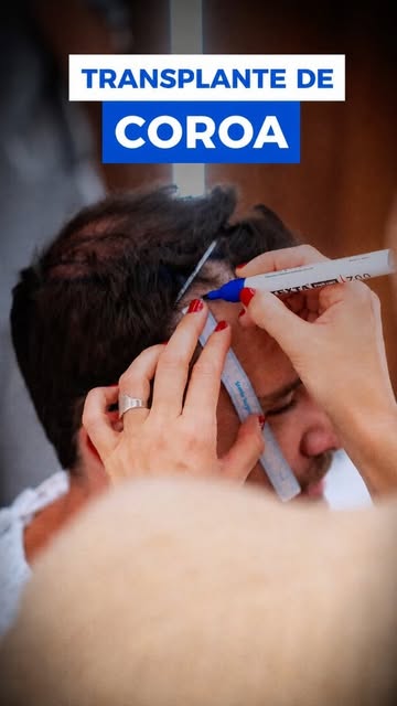 A falha na coroa te incomoda?

O paciente do dia possui uma falha importante na região posterior, na