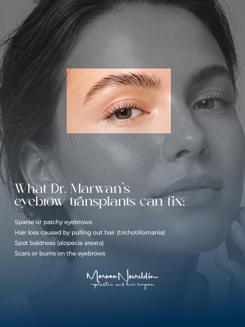 Eyebrows and eyelashes frame your face… but sometimes life, habits, or time can change their natural
