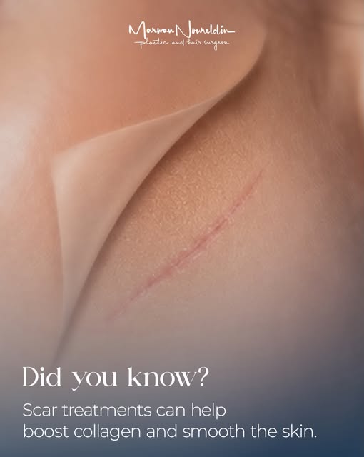 With the right treatment plan, scars can be improved to achieve a smoother and more natural-looking 