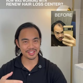 Jacob’s hair growth journey with Renew Hair Loss Center begins here. In four,  short, powerful video