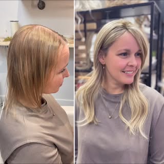 Une transformation qui change tout. ✨
Avec notre nouveau système de bonding, notre cliente retrouve 