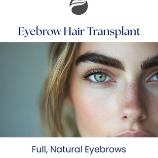 Get Natural-Looking Results With an Eyebrow Hair Transplant at FUEsion Hair Clinics.
Book Your Free 