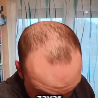 ￼Ha téged is zavar a kopaszodás, akkor dönts úgy, hogy bevállalod a változást🙂www.professionalhair.
