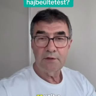 A beültetett hajszálak örök garanciásak, de akkor mégis miért van szükség egy második körre? A válas