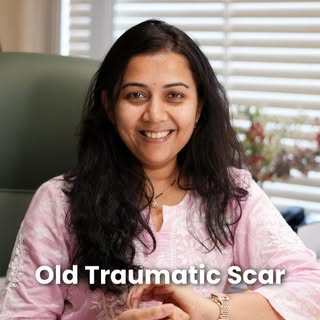 An old traumatic scar may be years old, but that doesn’t mean it can’t be improved.
The goal isn’t a
