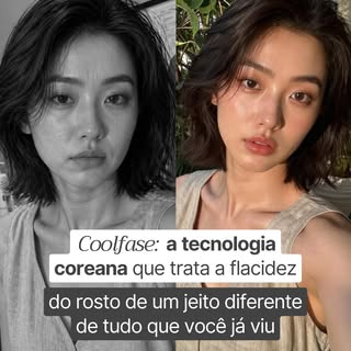 Novidade no consultório! 🤍

O Coolfase chegou e estou animada para compartilhar essa tecnologia com