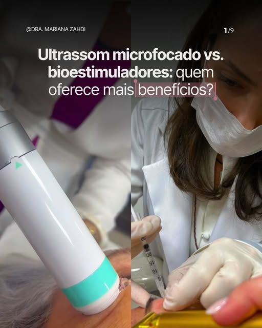 Ultraformer MPT e bioestimulador de colágeno são dois tratamentos que utilizo com frequência no cons