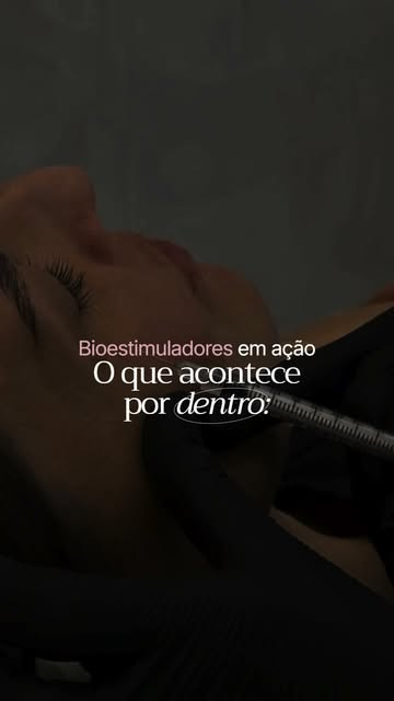 Você já se perguntou o que acontece dentro da pele quando aplicamos o bioestimulador? 🤍

É exatamen