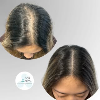 Amazing example of density SMP from our artist Tara 💯

For more information about SMP book your FRE
