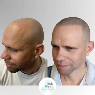 Precision is in the details. 🔎

​Check out this incredible transformation by our Perth artist, Tara