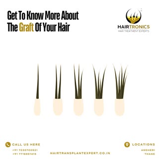 More Graft Denser Hair. Consult Hairtronics Now. Andheri-7030700521 / Thane- 7718851415

#hairtronic
