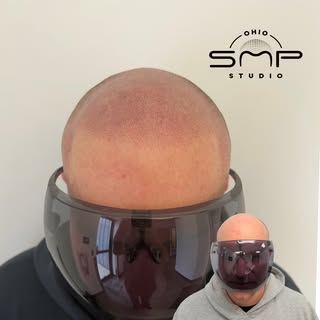 OHIO’s #1 SMP ARTIST💯 Scalp Micropigmentation is life changing with guaranteed results! Look younge