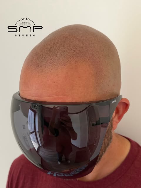 OHIO’s #1 SMP ARTIST💯 Scalp Micropigmentation is life changing with guaranteed results! Look younge