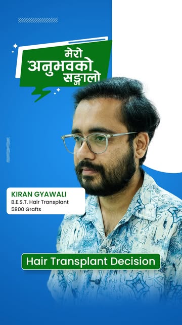 कपाल प्रत्यारोपण पछिको नयाँ लुक र फर्किएको आत्मविश्वास! 💇‍♂️✨
किरण ज्ञवाली ज्युको कपाल प्रत्यारोपणप