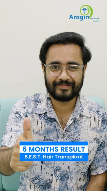 6 months after his B.E.S.T. Hair Transplant at Arogin Healthcare, Kiran Gyawali is loving his amazin