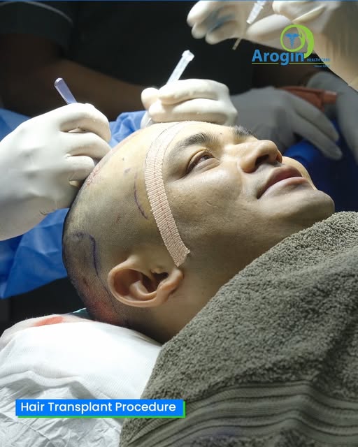 सुनिल जीको नयाँ लुक्स र उच्च आत्मविश्वासको राज — Arogin Healthcare सँगको B.E.S.T. Hair Transformatio