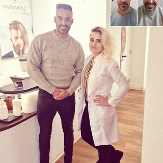 Zufriedener Patient 9 Monate nach Haartransplantation.. :) Ziel erfüllt✌️