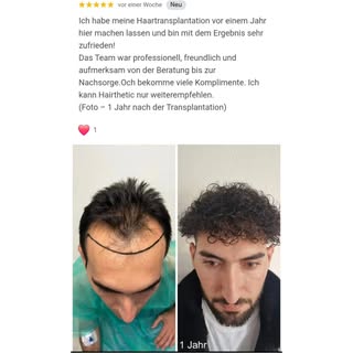 🌱 Ein Jahr später – ein neues Lebensgefühl

„Ich habe meine Haartransplantation vor einem Jahr bei 