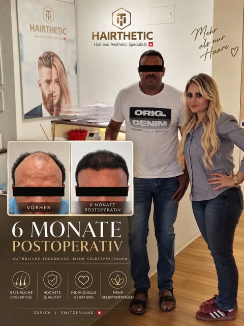 6 Monate Post Op

#haartransplantation_zürich #Haartransplantation #Haartransplantation_schweiz #hai