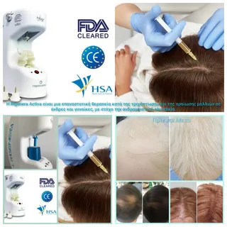 Τι είναι το AMT;

Η Autologous Micrografting Technology  είναι μια καινοτόμος, απλή και αποτελεσματι