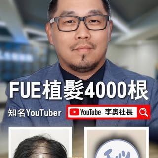 【台北植髮4000根心得】《WSD酒訊雜誌》李奧社長也選擇MyHair診所！  #myhair生髮植鬍診所 #林敬恩醫師 #李奧社長  @leowumr5 ​

植髮立即詢問 👉 https://l