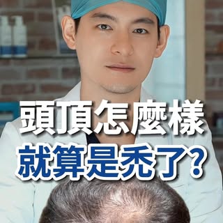 頭頂怎樣算禿？
高雄MyHair生髮植鬍診所院長 - 林士棋醫師

#頭頂禿 #雄性禿 #林士棋醫師 #生髮 #生髮水 #生髮慕斯  #植髮 #植髮手術 #植髮診所 #myhair生髮植鬍診所 #my