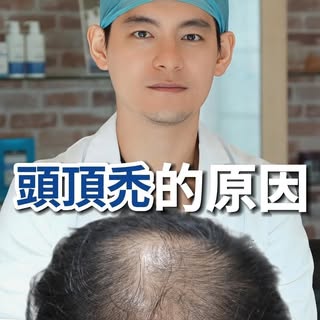 頭頂禿頭原因是甚麼？
高雄MyHair生髮植鬍診所院長 - 林士棋醫師

#頭頂禿 #雄性禿 #林士棋醫師 #生髮 #生髮水 #生髮慕斯  #植髮 #植髮手術 #植髮診所 #myhair生髮植鬍診所 