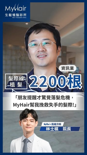 【植髮案例】髮際線失守怎麼辦？高雄 MyHair 林士棋院長量身設計植髮 2200 根，重塑自然毛流
立即詢問 👉 https://lin.ee/CZz81Vs

✔️專業術後服務流程，毛囊高存活率