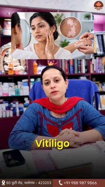 त्वचेवरचा प्रत्येक पांढरा डाग म्हणजे Vitiligo नसतो!

पण डाग दुधासारखा पांढरा दिसत असेल, हळूहळू वाढत 