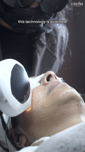 Camera-ready skin starts with the right care. ✨
Photofacial at Ethoski — for a fresher, more refined