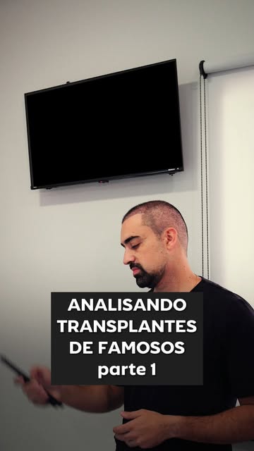 Nem todo resultado de transplante capilar que parece natural é feito da mesma forma.

Neste vídeo, a