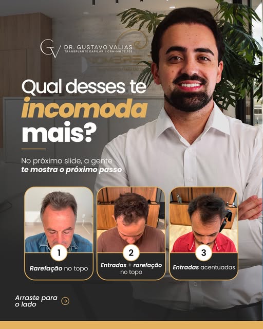 Qual dessas situações mais incomoda você?

Entradas mais acentuadas, rarefação no topo ou perda de d